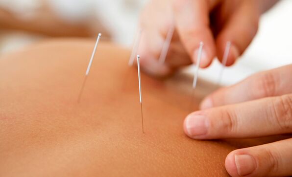 akupunktura pro zvýšení potence
